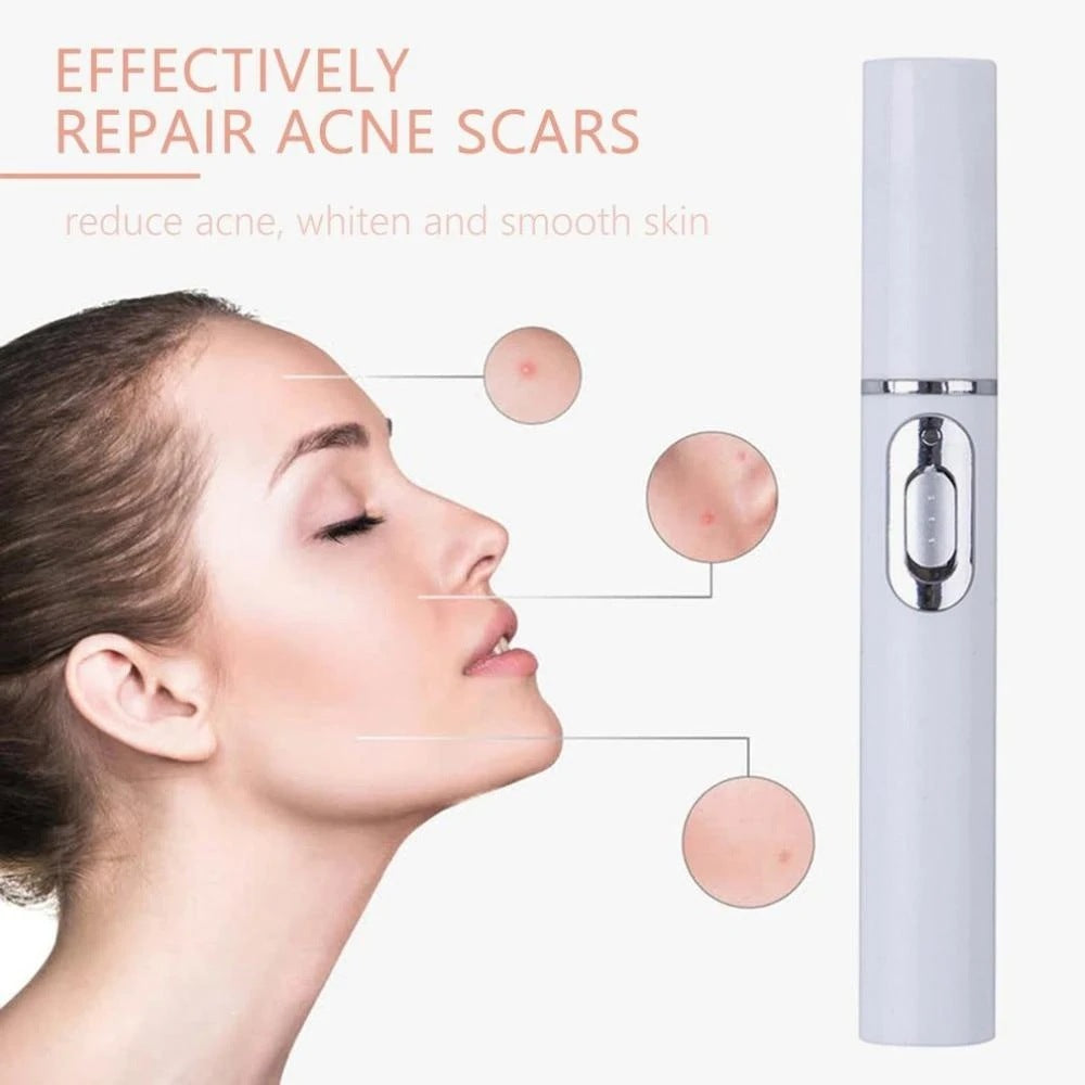 Acne Therapy Wand