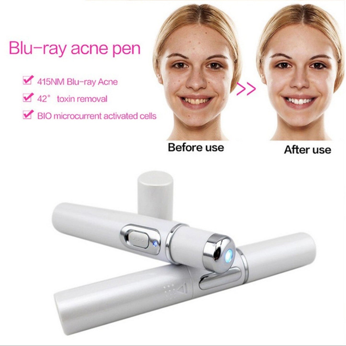 Acne Therapy Wand